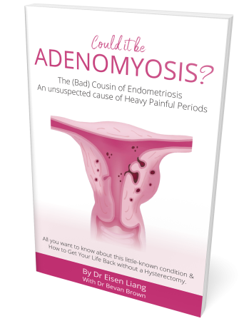 Our Book "Could it be Adenomyosis? The Bad Cousin of Endometriosis" 1st Ed 2021.